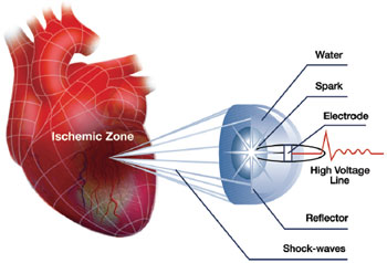 ����� ������� ������ �� Cardiospec