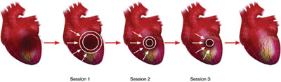 ������������� ����������� ������ ������� �� cardiospec